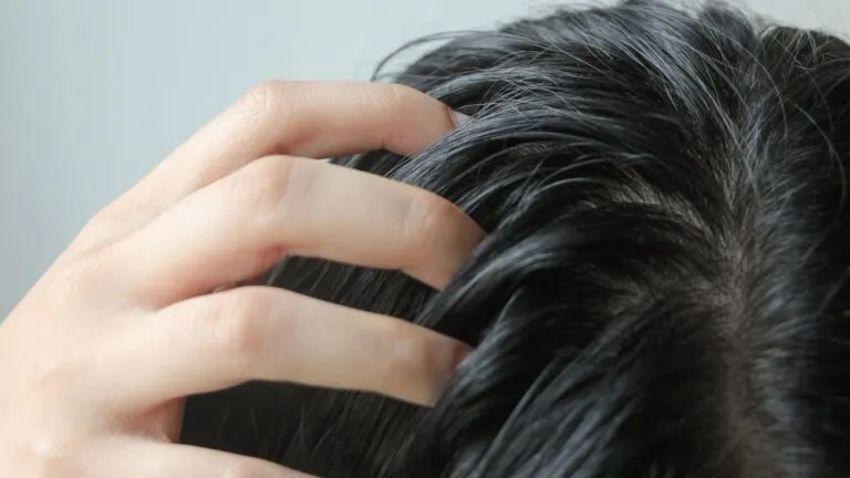 rambut berminyak