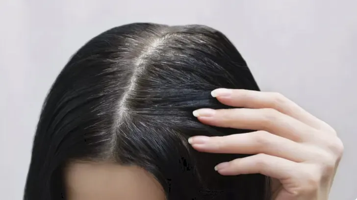 Rambut Beruban di Usia Muda: Penyebab, Mitos, dan Cara Mengatasinya