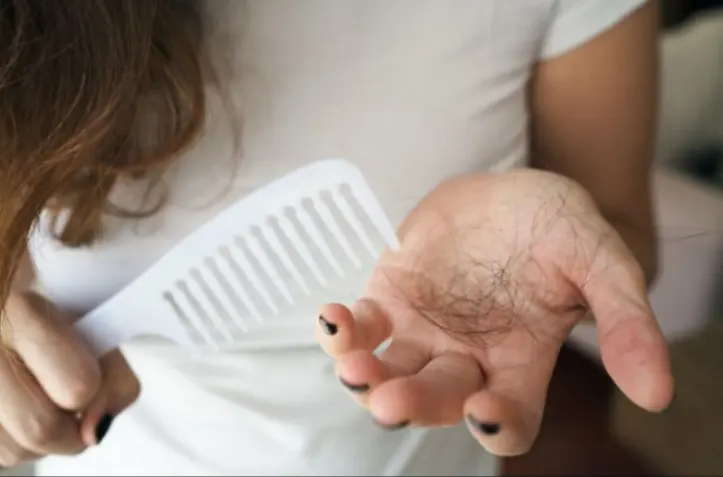 Efek Samping Kekurangan Vitamin D Terhadap Kerontokan Rambut