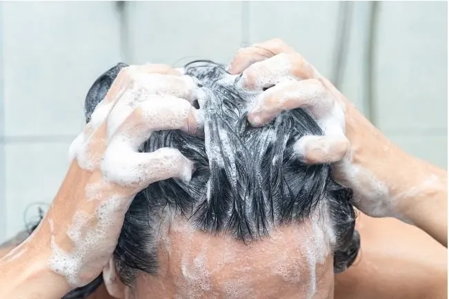 5 Kebiasaan Sepele Saat Keramas yang Justru Bikin Ketombe Makin Parah