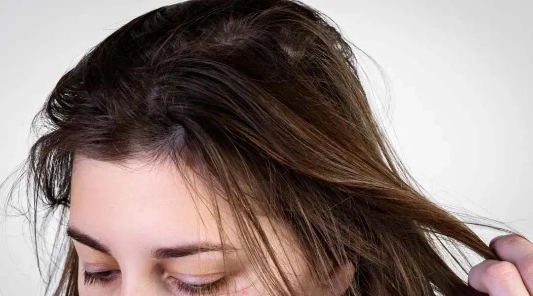 rambut lepek
